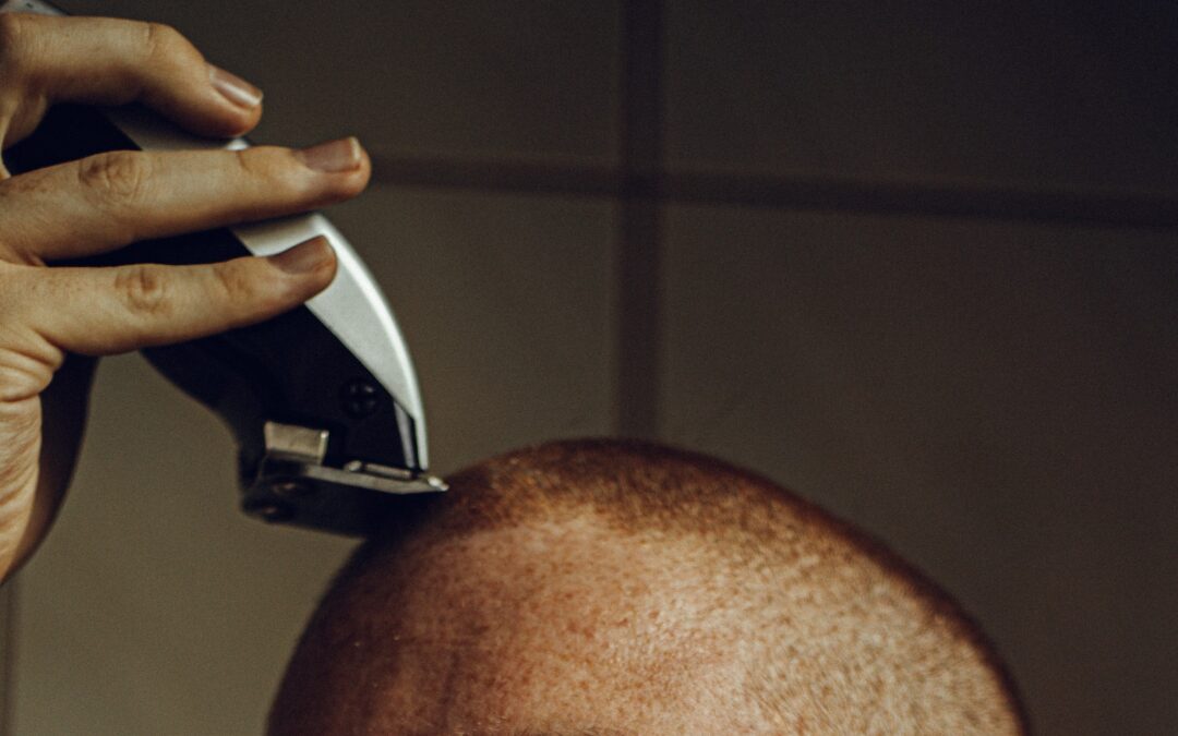 Does Shaving Your Head Cause Balding?
